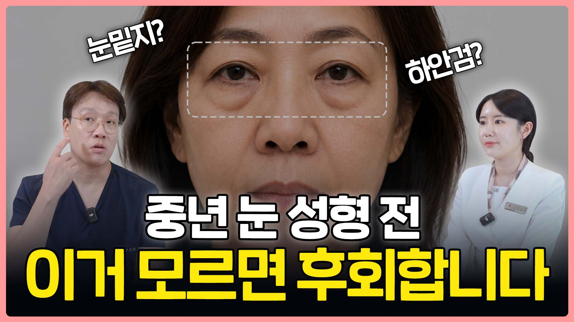 부산 하안검 수술 알아본다면 중요한 '이것'